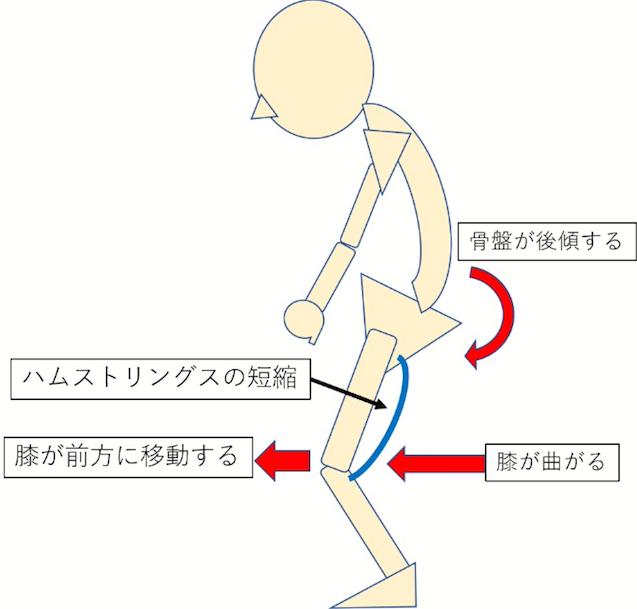 札幌白石区整体【猫背骨盤矯正専門】カラダカイロ　