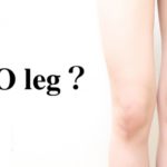 あなたのO脚の原因は？正しく矯正してキレイなスタイルを！