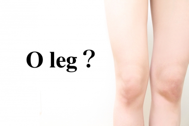 あなたのO脚の原因は？正しく矯正してキレイなスタイルを！